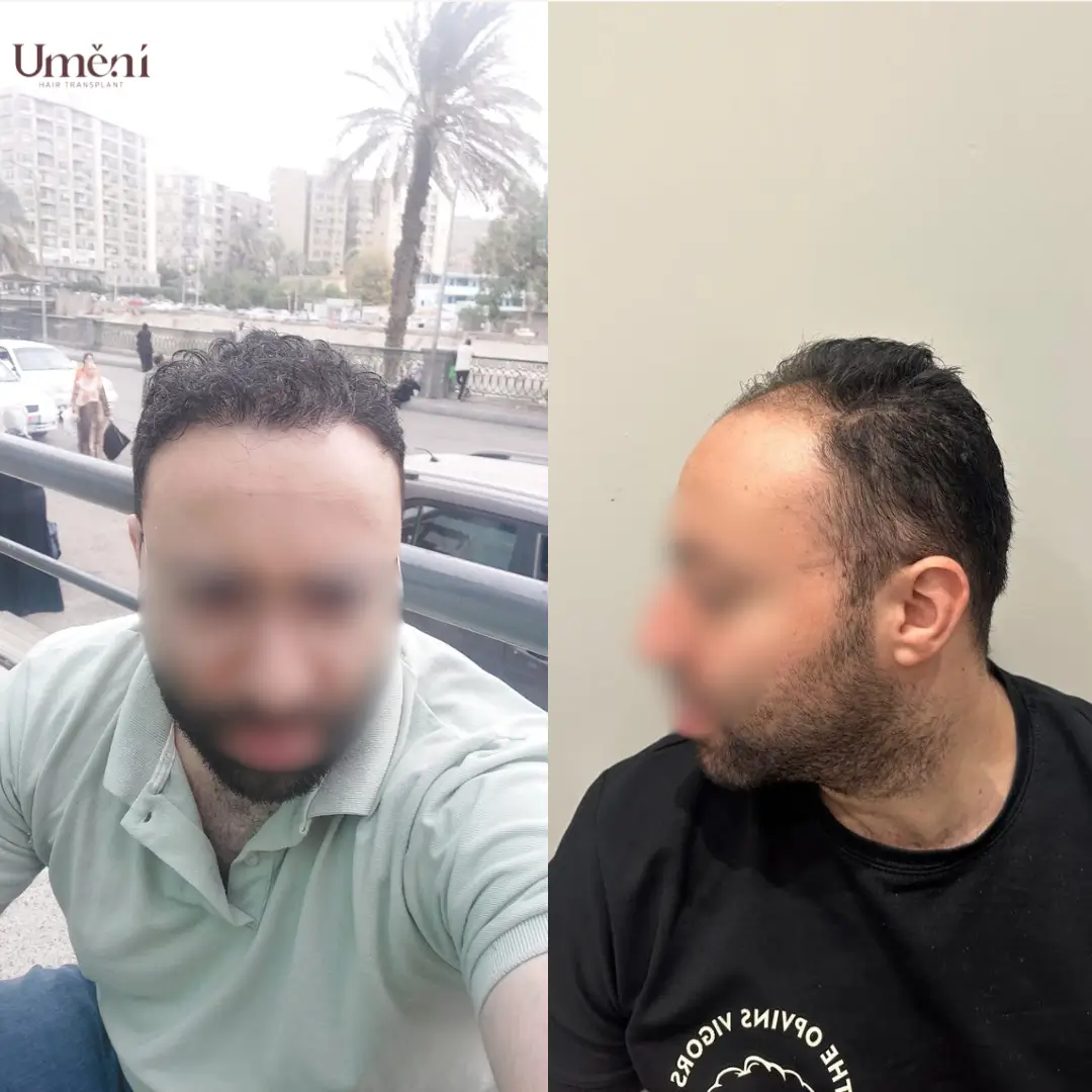قبل وبعد 3